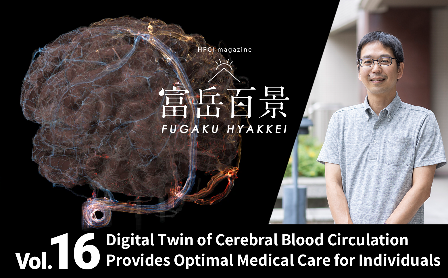 Digital Twin of Cerebral Blood Circulation Provides Optimal Medical Care for Individuals